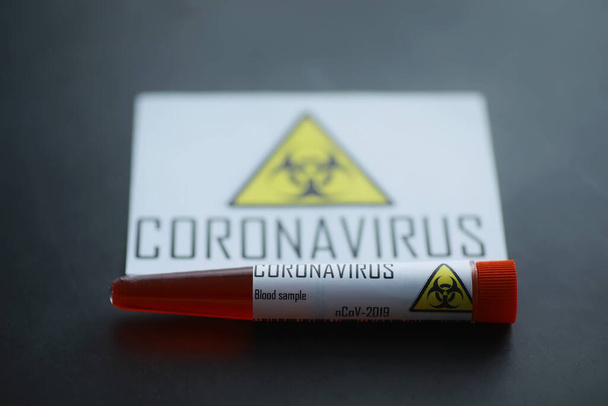 A blood sample for testing the dangerous virus coronavirus in body. Test tubes with tests for coronavirus. Laboratory studies of viral diseases. - Foto, immagini