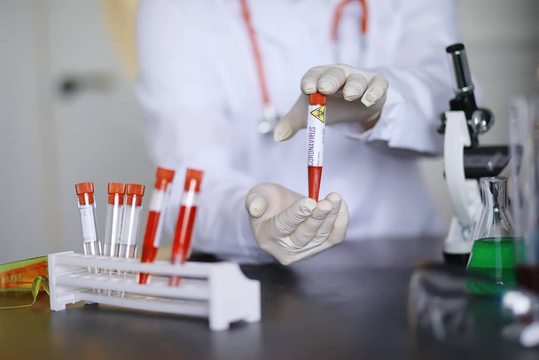 Laboratuvardaki bir bilim adamı viral zatürreenin tedavisi için ilaçları test ediyor. Hastalıklı hastaların Coronovirus kan testi. Dünya salgını. - Fotoğraf, Görsel