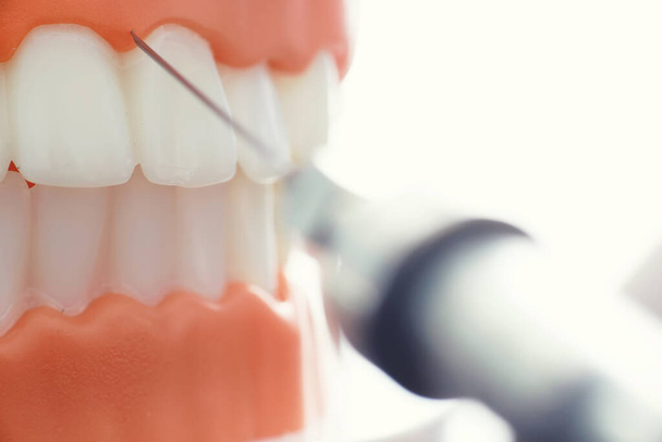 Zahnarztpraxis. Zahnarzt untersucht die Behandlung der Mundhöhle. Der Arzt zeigt einen Behandlungsablauf. Kariesbehandlung. Implantation und Einbau von Furnieren. - Foto, Bild