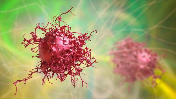 Cellules cancéreuses cervicales, illustration 3D. Tumeur maligne du col utérin - Photo, image