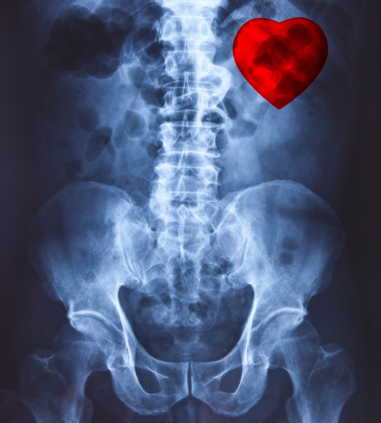 Lantion ja selkärangan röntgenkuvaus
 - Valokuva, kuva