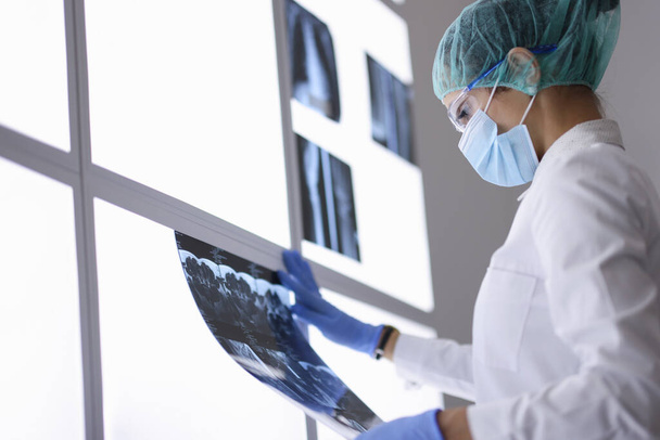 Médico en máscara médica protectora y guantes examina una radiografía. - Foto, Imagen