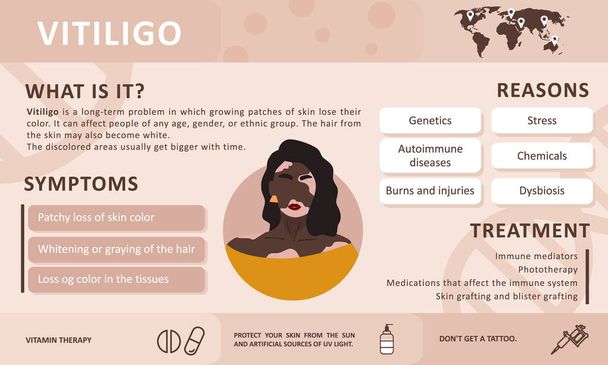 Infographics van vitiligo. Oorzaken van de ziekte. Abstracte Afrikaanse vrouw silhouet. Vector concept ter ondersteuning van mensen die leven met vitiligo en om het bewustzijn over chronische huidaandoening op te bouwen. Zelfverzorging. - Vector, afbeelding