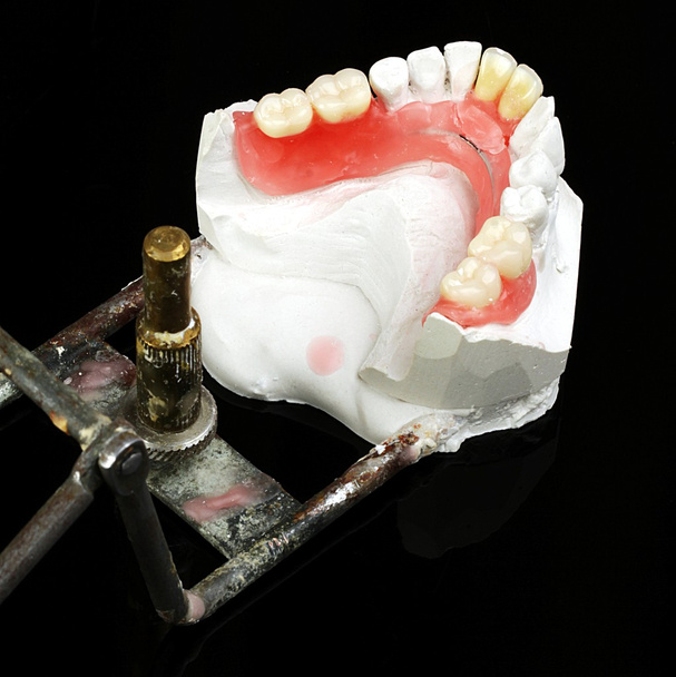 Próteses dentárias
 - Foto, Imagem