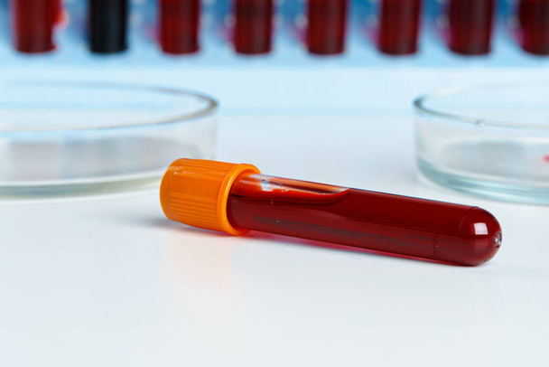 Blood sample tubes medical equipment close up - Foto, immagini