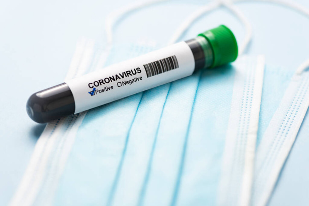 Chirurgische Maske mit positivem Coronavirus-Reagenzglas auf blauem Hintergrund. Coronavirus-Schutzkonzept (COVID19). Medizinische Atemmaske. Persönliche Schutzausrüstung. - Foto, Bild