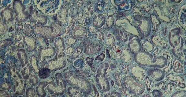 Tissu humain du rein à fort grossissement au microscope 100x  - Séquence, vidéo