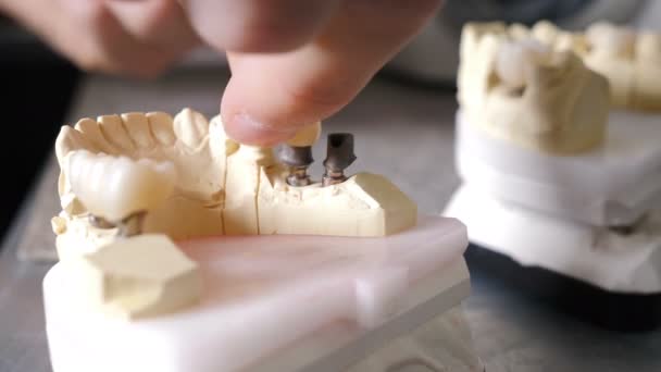 Zubní protéza, umělý zub, protéza. Mužské ruce nastavují zubní korunu na čelistní model. Ruce pracují na zubním protéze. Pohled zblízka. 4 k video - Záběry, video