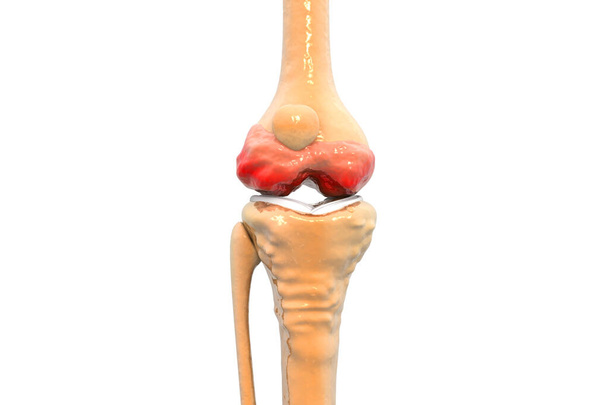 Anatomia dell'articolazione del ginocchio umano. Illustrazione 3d - Foto, immagini