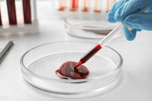 Scientist dripping blood from pipette into Petri dish at table, closeup. Laboratory analysis - Fotó, kép