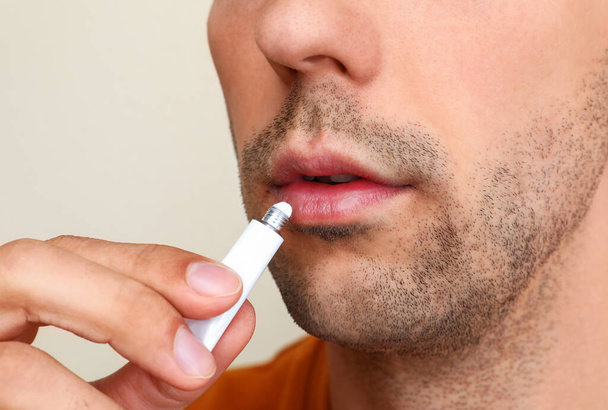 Young man with cold sore applying cream on lips against light background, closeup - Foto, Imagen