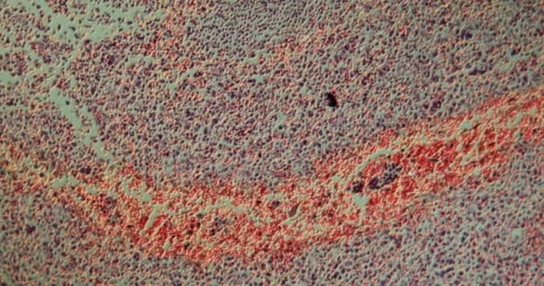 jednokomórkowa białaczka o dużym powiększeniu 100x pod mikroskopem - Materiał filmowy, wideo