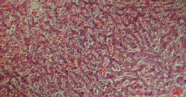 Fígado em ouriços após choque com alta ampliação sob o microscópio 100x - Filmagem, Vídeo