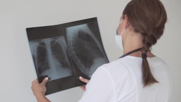 Γυναίκα γιατρός εξετάζει X-ray των πνευμόνων που επηρεάζονται από covid-19, - Πλάνα, βίντεο