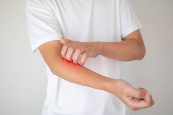 férfi viszketés és karcolás viszkető száraz bőr ekcéma dermatitisz - Fotó, kép