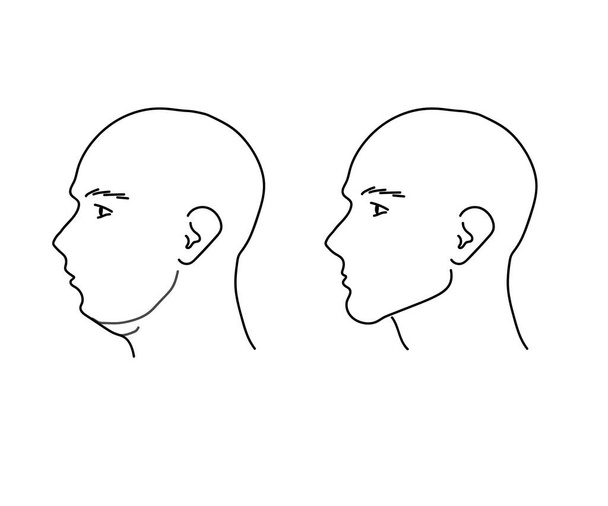 Silhouette di un volto maschile sullo sfondo. Correzione della forma del viso e del mento. Illustrazione vettoriale. - Vettoriali, immagini