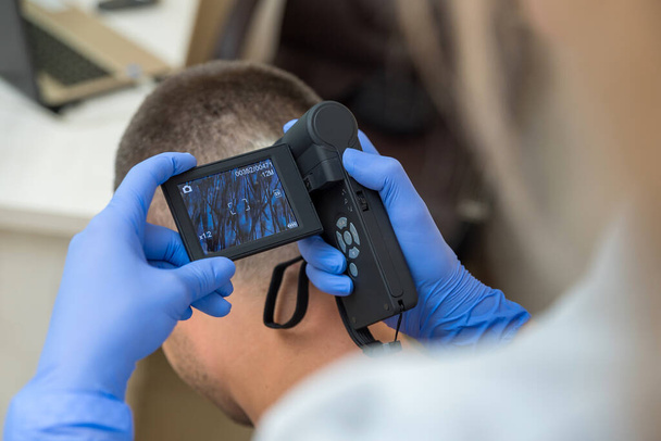 el médico examina el cuero cabelludo del paciente con un dispositivo óptico - Foto, Imagen
