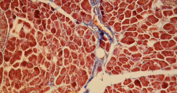 顕微鏡下で高倍率でLangerhanのアイソレット細胞を持つ膵臓100倍 - 映像、動画