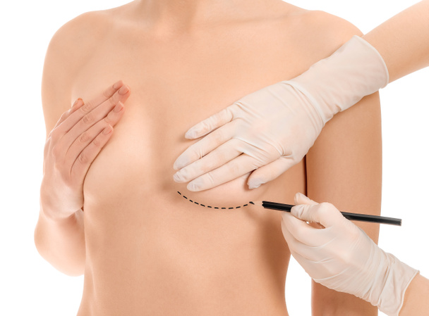 Arzt trägt Markierung auf der Brust der Frau vor weißem Hintergrund auf. Konzept der Brustvergrößerung - Foto, Bild