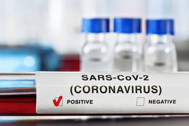 Sample vial with blood, label says coronavirus test, positive result. Blurred laboratory equipment background. Covid 19 outbreak concept - Photo, image