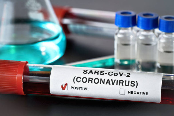 Sample vial with blood, label says coronavirus test, positive result. Blurred laboratory equipment background. Covid 19 outbreak concept - Valokuva, kuva