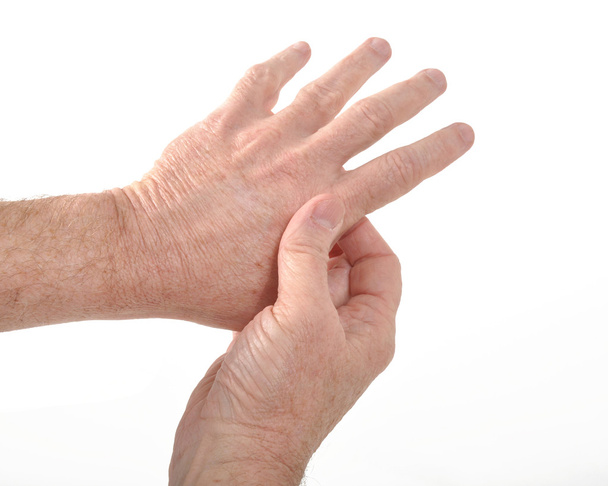 Arthritis - Foto, Bild