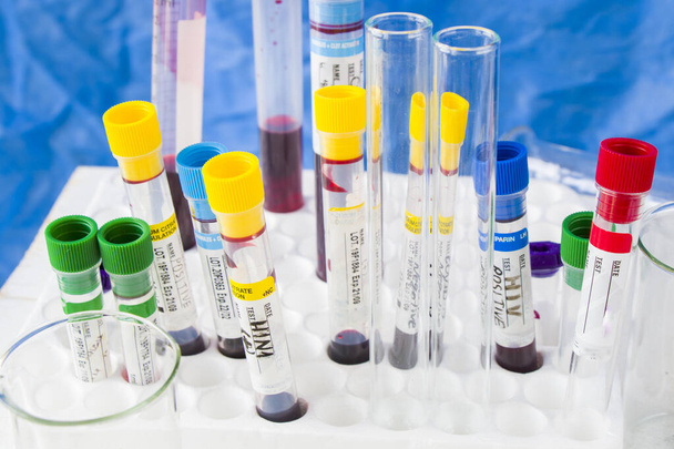 Mesa de laboratorio, muestras de tubos de análisis de sangre y cristalería con elementos químicos líquidos. - Foto, Imagen