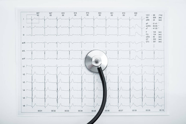 Stetoscopio medico e risultati ecg come grafico. Patologie cardiache nella grafica. Diagnosi di infarto. - Foto, immagini