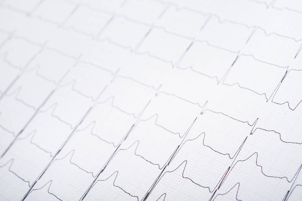 Foto di primo piano del cardiogramma ECG grafico a impulsi su un foglio. battito cardiaco linea medica. - Foto, immagini