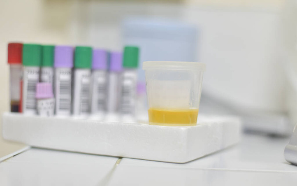 İdrar tahlili için idrar Test Laboratuvarı Ekipmanı Sarı Kapak Tüpleri Boş doldurulmuş donmuş ve dipstick simgesi izole edilmiş elementleri ayarla. - Fotoğraf, Görsel