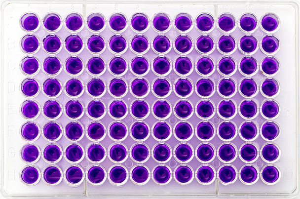 Meerkanaals pipetlading biologische monsters in microplaat voor test in het laboratorium / meerkanaals pipetteerlastmonsters in pcr microplaat met 96 putjes. - Foto, afbeelding