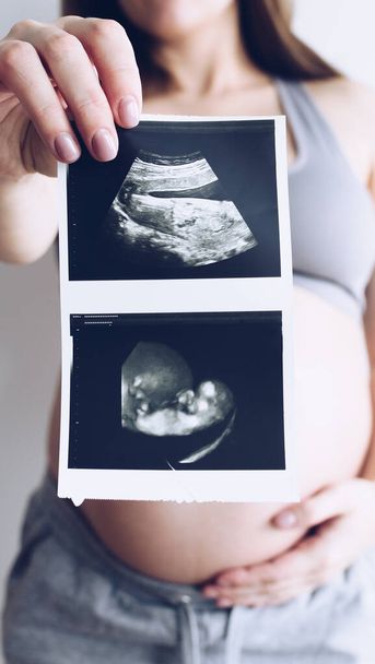 Έγκυος με υπέρηχο στο μωρό της. Έγκυος γυναίκα κρατά το στομάχι της και μια φωτογραφία του υπέρηχου της. - Φωτογραφία, εικόνα