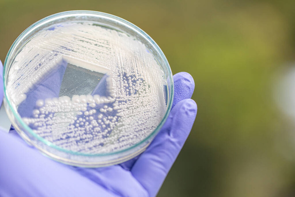 ペトリ皿の酵母、研究室での教育のための微生物学. - 写真・画像