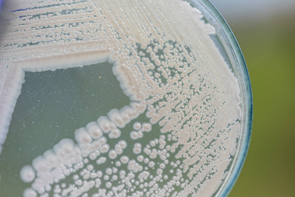 Levadura en placa de Petri, Microbiología para la educación en laboratorios. - Foto, imagen