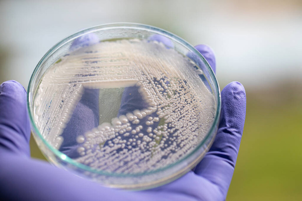 Levadura en placa de Petri, Microbiología para la educación en laboratorios. - Foto, imagen