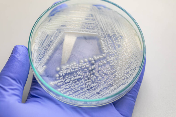 Lievito in capsule di Petri, Microbiologia per l'educazione nei laboratori. - Foto, immagini