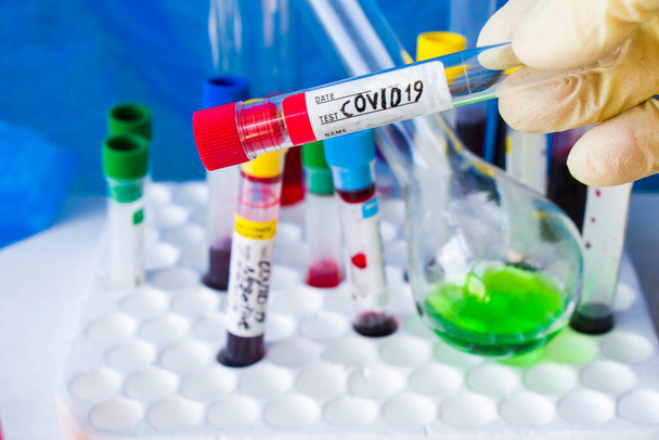 Covid - 19 and corona virus blood test sample, negative and positive tests in doctors hand - Photo, Image
