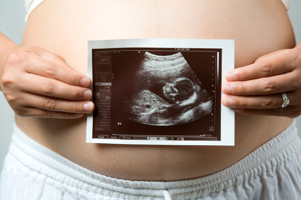 вагітна жінка
 - Фото, зображення
