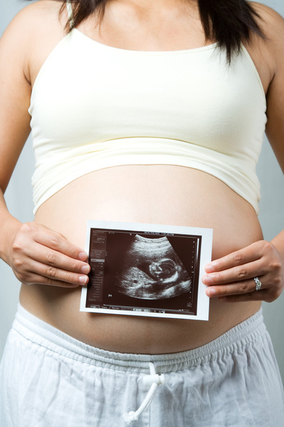 Mujer embarazada. - Foto, Imagen