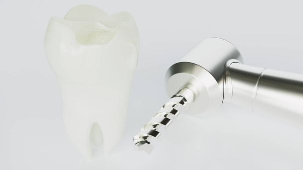 Se perforó un diente - 3D Rendering - Foto, imagen