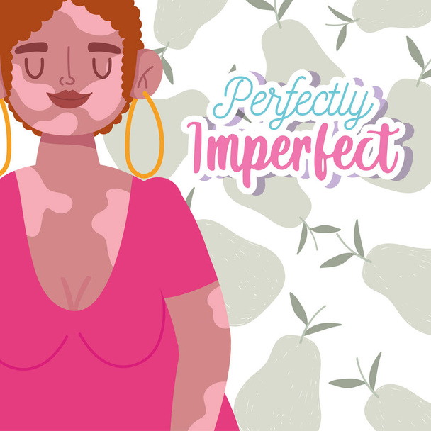 perfectly imperfect, cartoon woman curly hair and vitiligo on body - Vector, Image