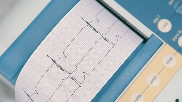  electrocardiograph EKG or ECG diagram printed on grid paper. - Zdjęcie, obraz