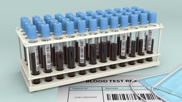 Negativer Bluttest zur Virenerkennung mit der Analyse und den Gesichtsmasken - Filmmaterial, Video