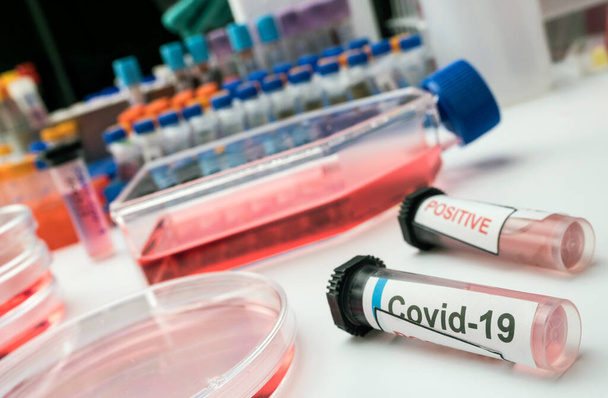 A SarsCov2 coronavirus injekciós üvege, fogalmi kép - Fotó, kép