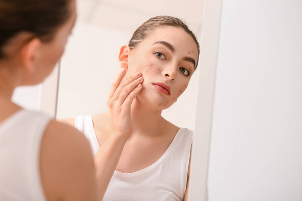 Młoda kobieta z problemem trądziku patrząc w lustro - Zdjęcie, obraz