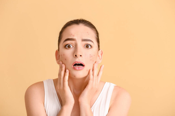 Gestresste junge Frau mit Akne-Problem auf farbigem Hintergrund - Foto, Bild