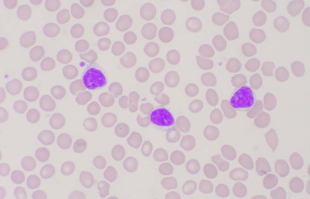 Mature lymphocyte on red blood cells medical background. - Photo, Image