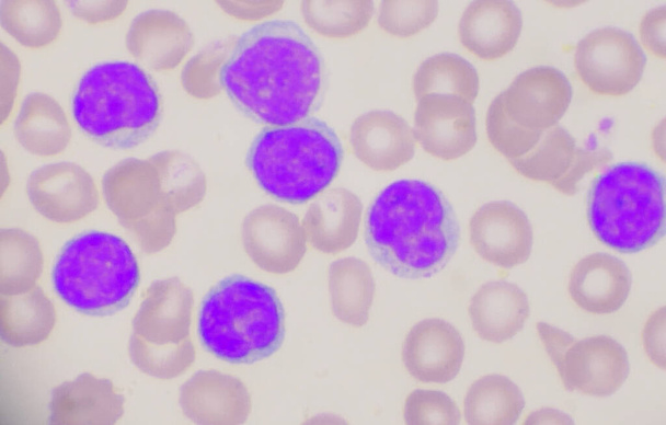 Dojrzałe limfocyty na czerwonych krwinkach tło medyczne. - Zdjęcie, obraz