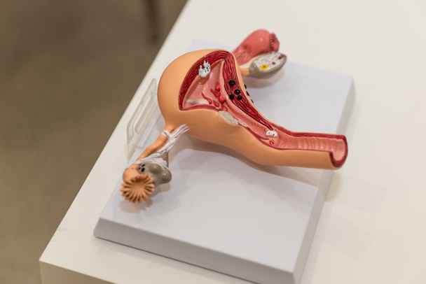 Ανατομία της μήτρας, σάλπιγγες και ωοθήκες για παράδειγμα του ανατομικού μοντέλου των γυναικείων γεννητικών οργάνων. Έννοια για τη μελέτη της ανατομίας της μήτρας και των προσαρτημάτων, απεικόνιση του γυναικείου αναπαραγωγικού συστήματος - Φωτογραφία, εικόνα