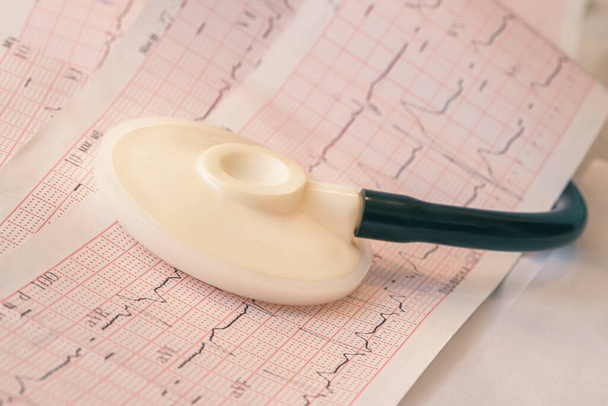 phonendoscope βρίσκεται στο διάγραμμα καρδιακών παλμών. Ιατρικό καρδιογράφημα για την εξέταση καρδιακών παθήσεων. - Φωτογραφία, εικόνα